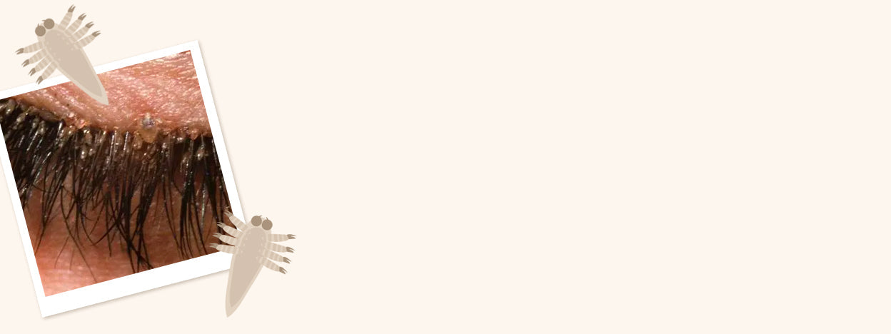 What Are Lash Mites? Blog Banner